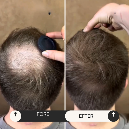 HairFix – Hair concealer