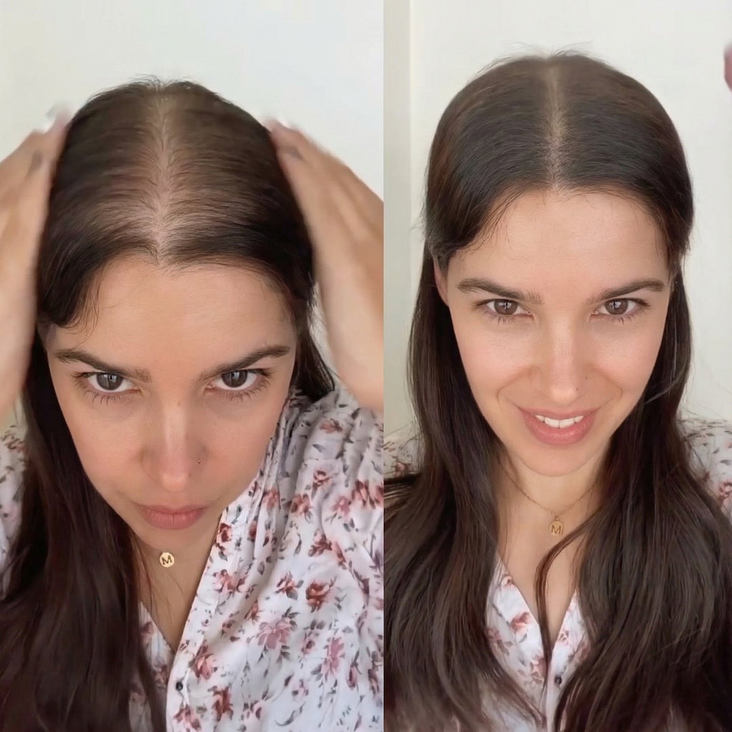 HairFix – Hair concealer