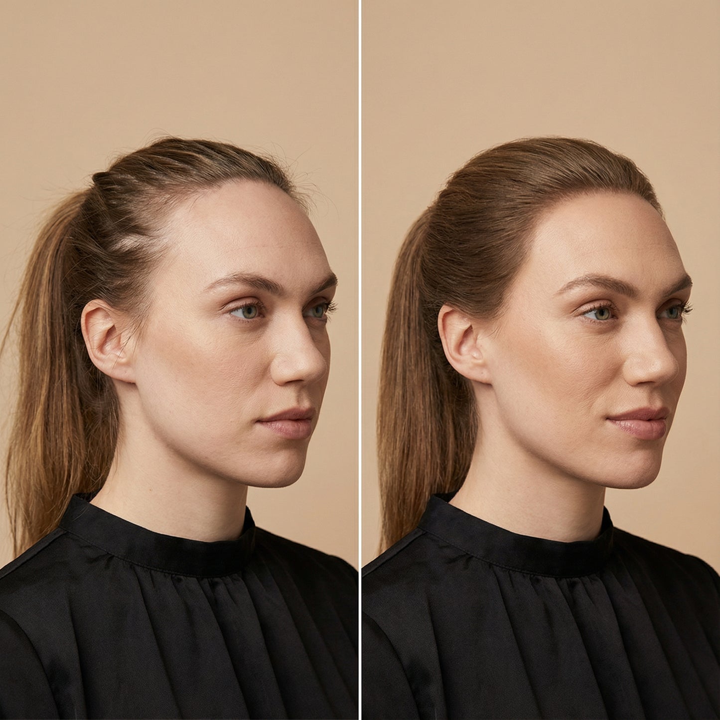 HairFix – Hair concealer